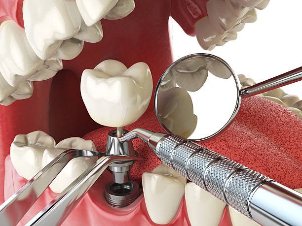 Best Broken Tooth Emergency  in Chubbuck, ID